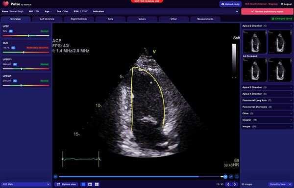 2021.09.17-heartlab-pulse